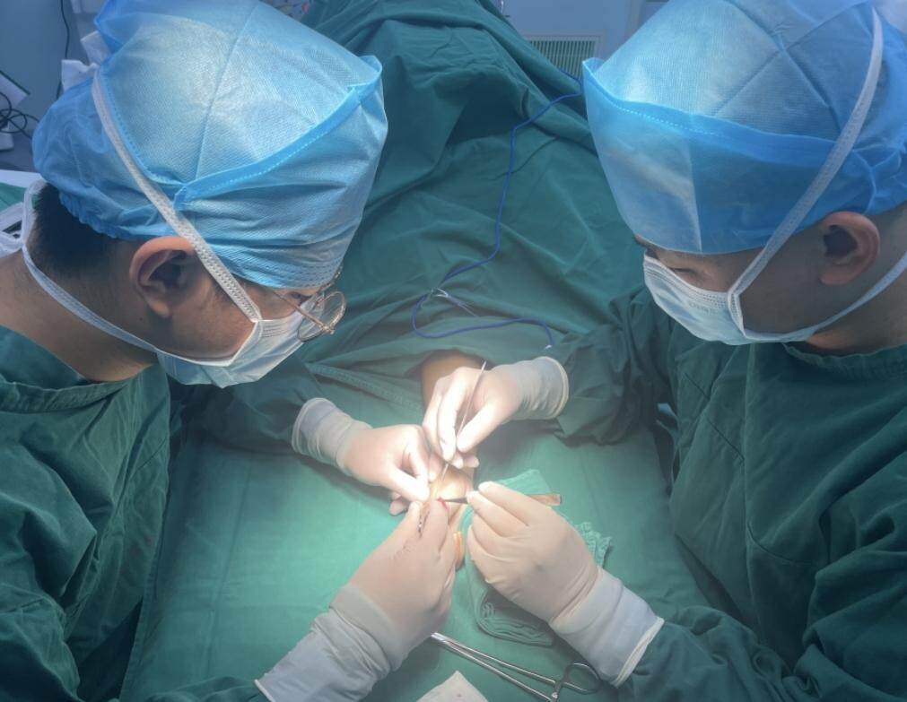 36岁多指畸形术后仍畸形_多指切除简单一刀切术后仍需二次矫正_做多指手术要多少钱